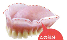 soft-dentture.jpg